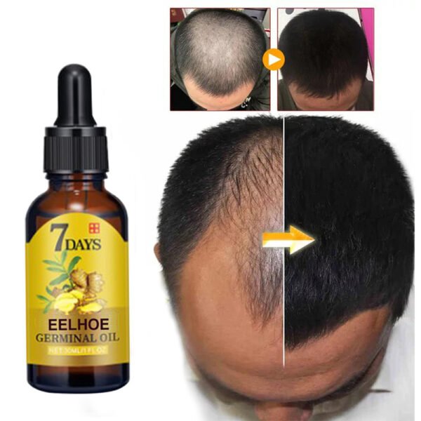 Soin Capillaire au Gingembre 20ml – Image 3